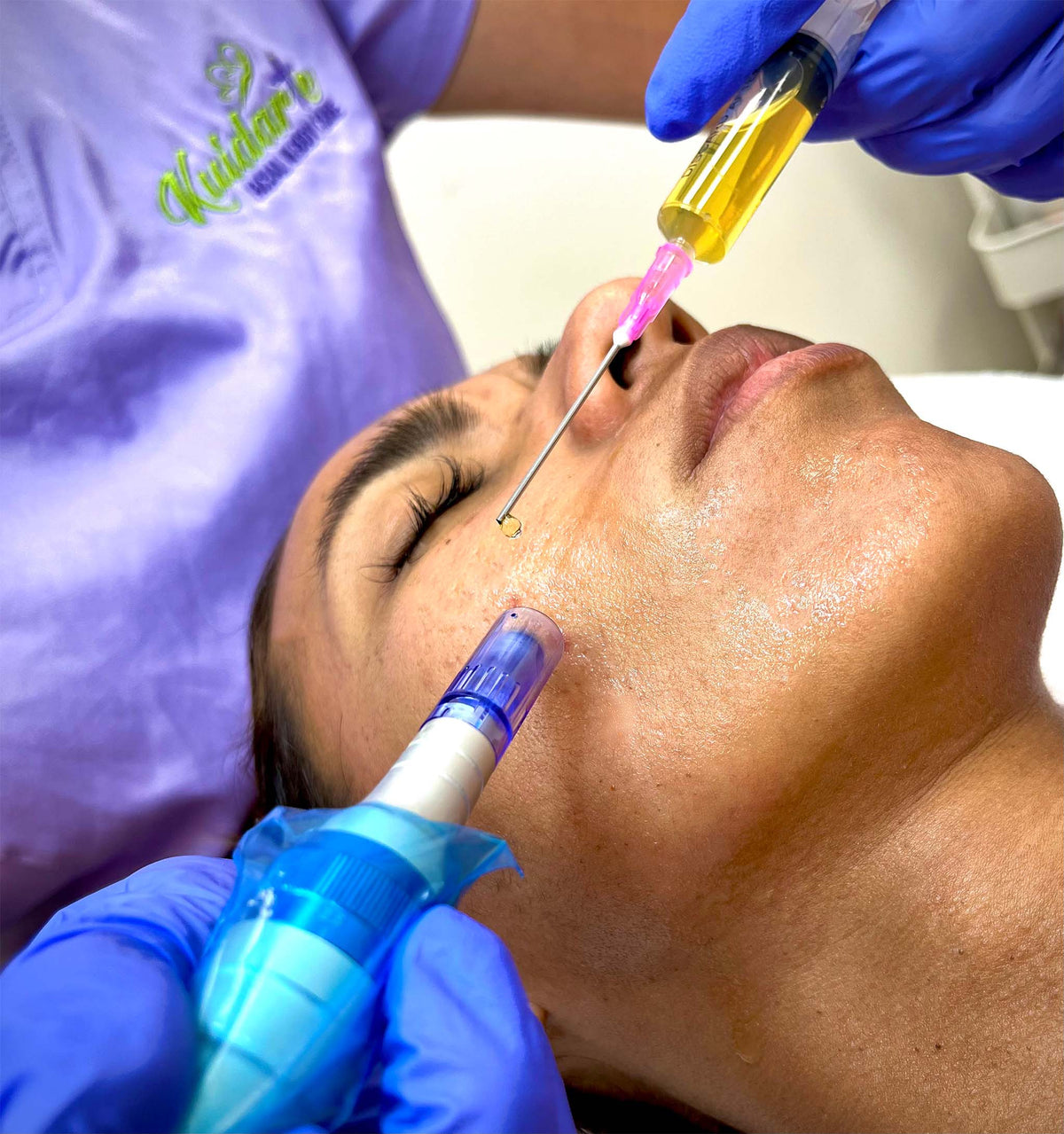 PRP PLASMA RICO EN PLAQUETAS KUIDARTE